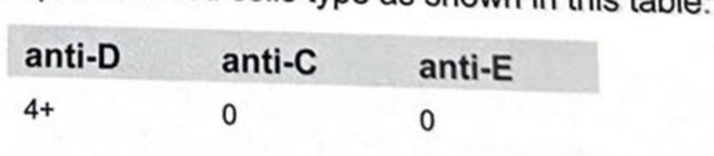 <p>A patient's red cells type as shown in the table. Which of the following genotype would be consistent with these results?</p><p>a R0R0</p><p>b R1r</p><p>c R1R2</p><p>d Rzr</p>