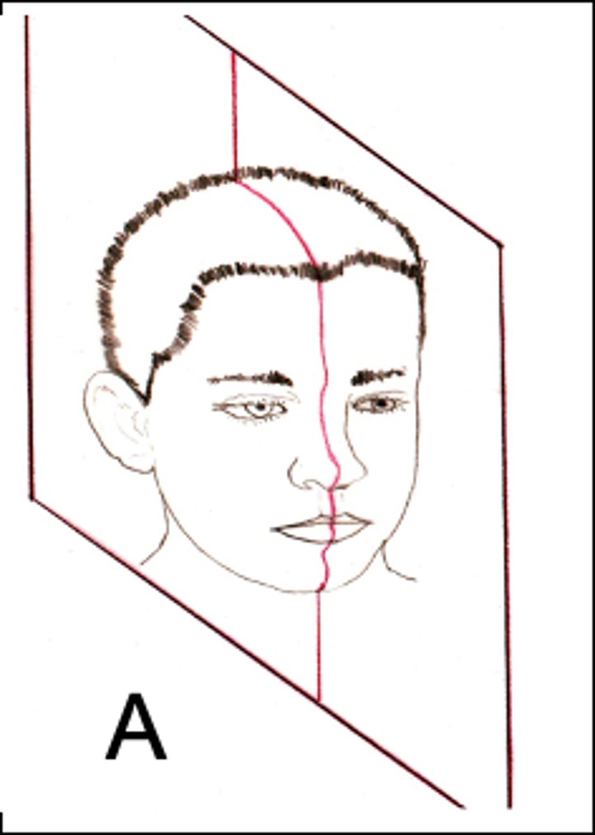 <p>ID the plane of orientation:</p>