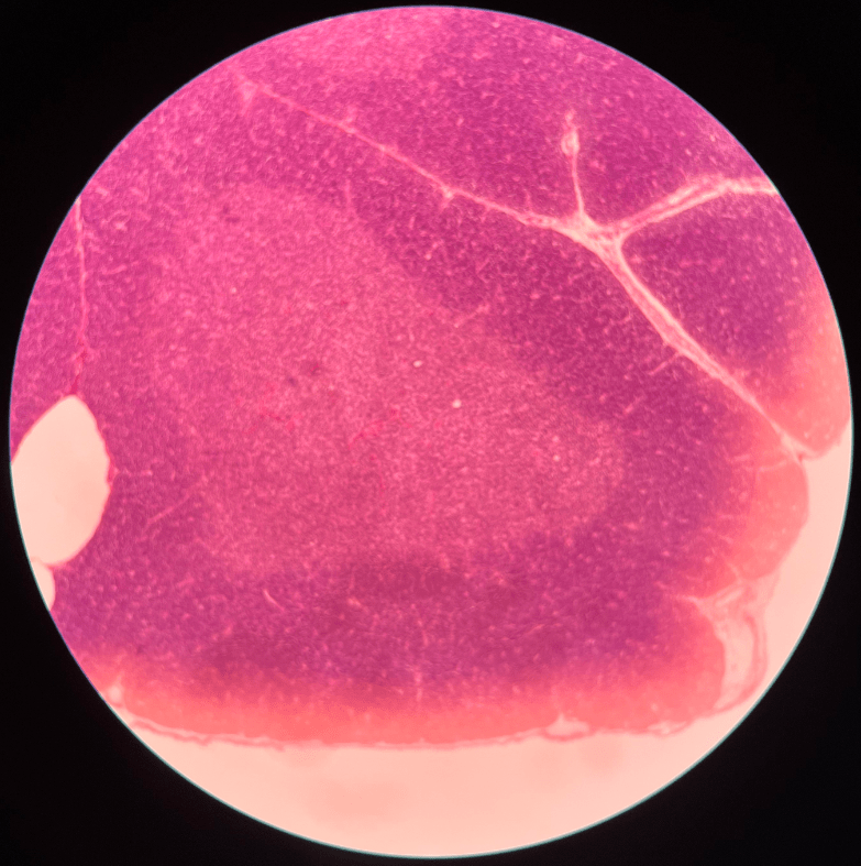• Located in the superior mediastinum of the thoracic cavity and posterior to the sternum.

• Composed of many lobules.

• Site of T lymphocyte maturation.