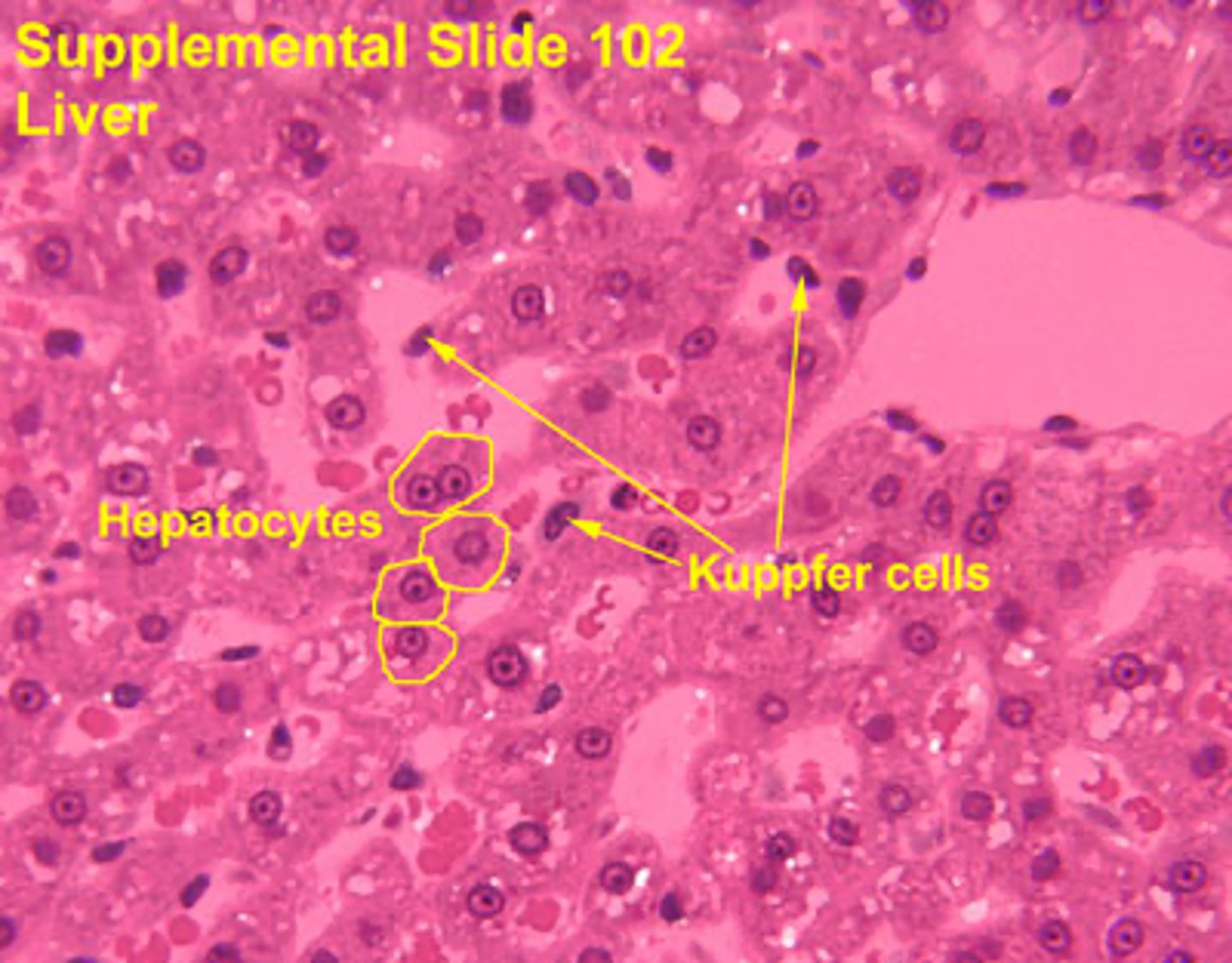 <p>Kupffer cells are specialized phagocytic cells found in the liver that originate from monocytes in the bloodstream.</p><p>THEY ARE BLACK DOTS, DARKER THAN HEPATOCYTES</p><p>Interspersed among the sinusoidal lining cells but form no junctions with them</p>