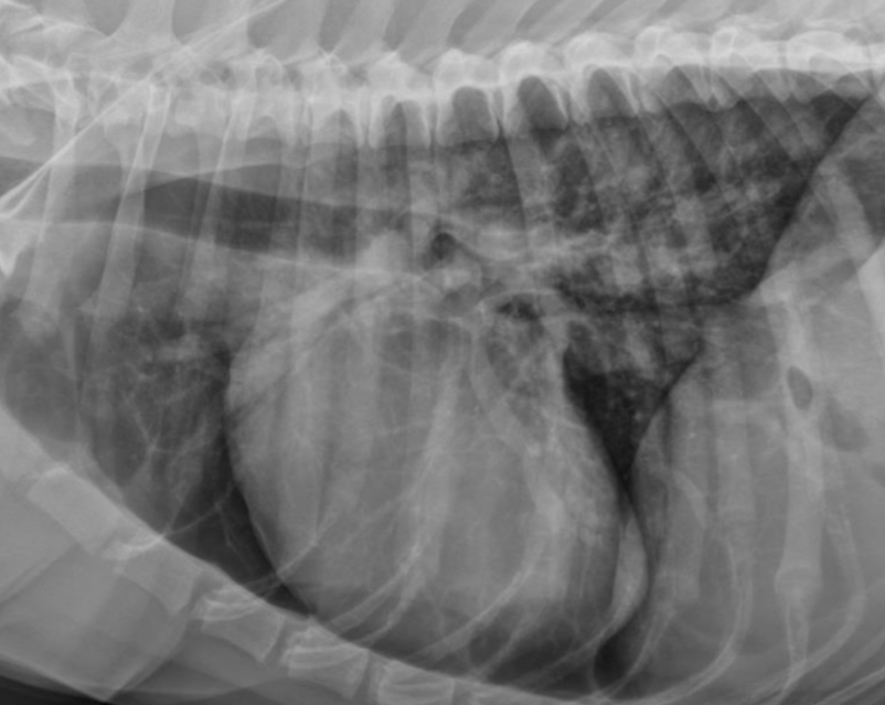 <p>What part of the heart is enlarged?</p>