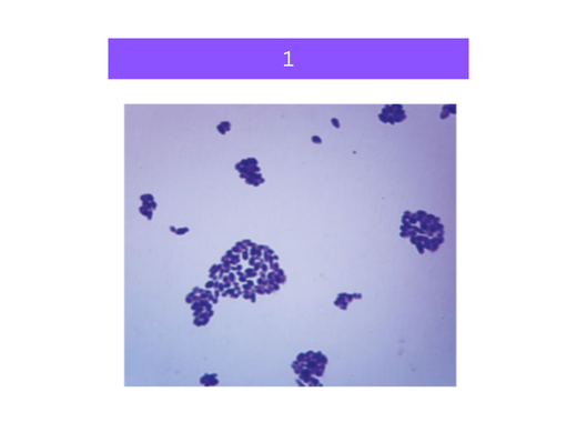 <p>what is&nbsp;1</p>
