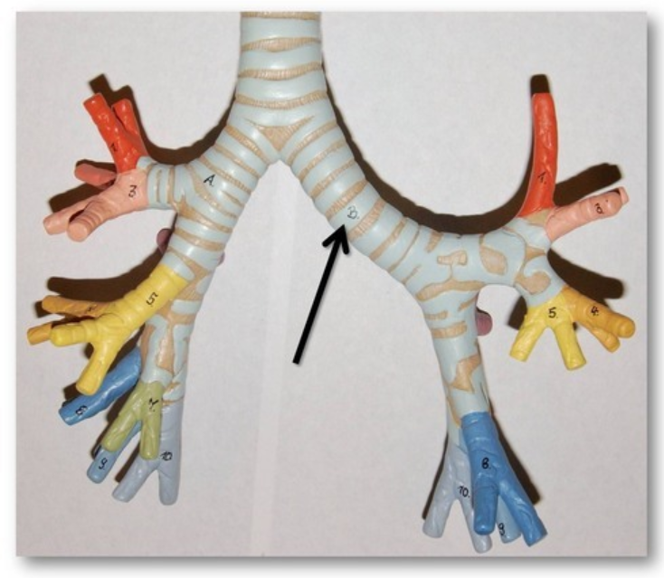 The primary airway branches that lead from the trachea into each lung (right and left).