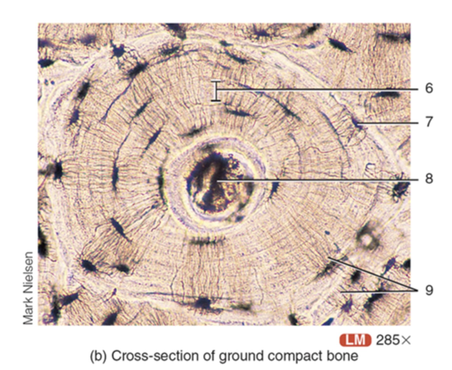 <p>osteonic canal</p>