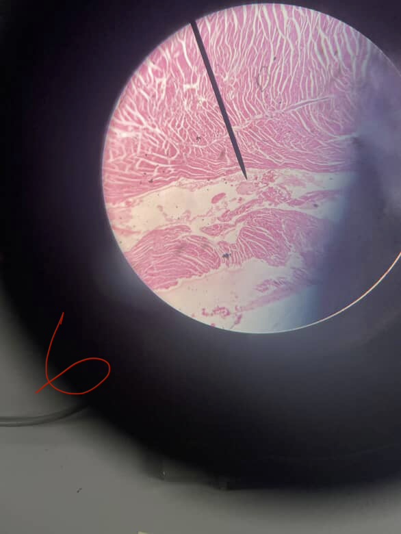 <p>Name the muscle</p>