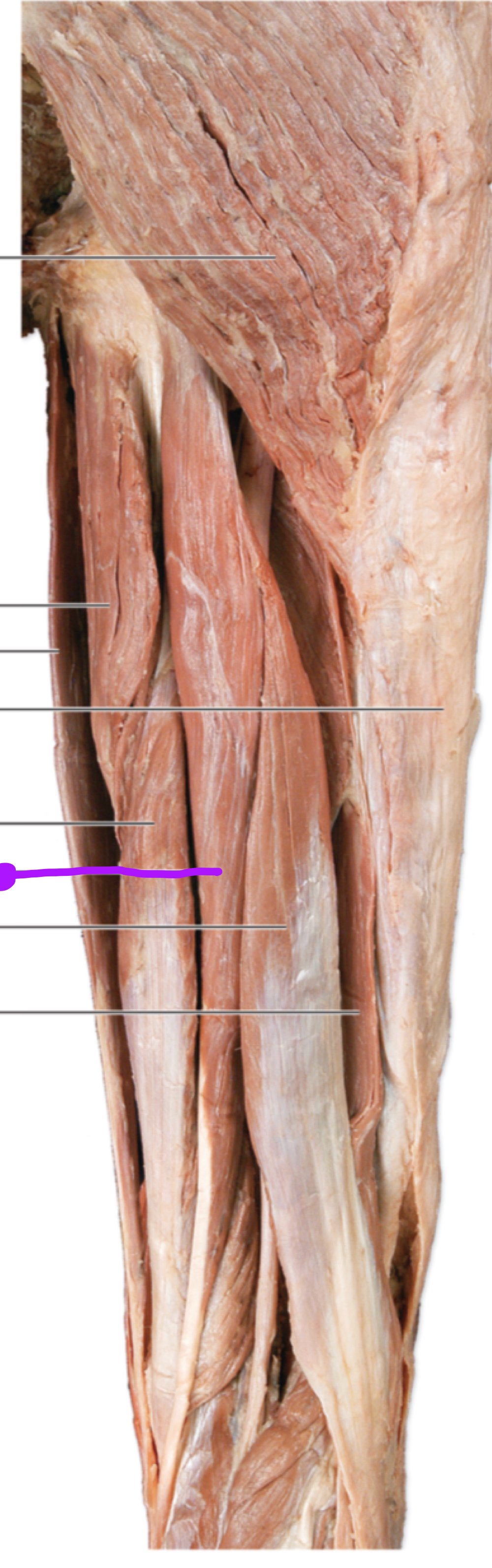 <p>Innervation</p>