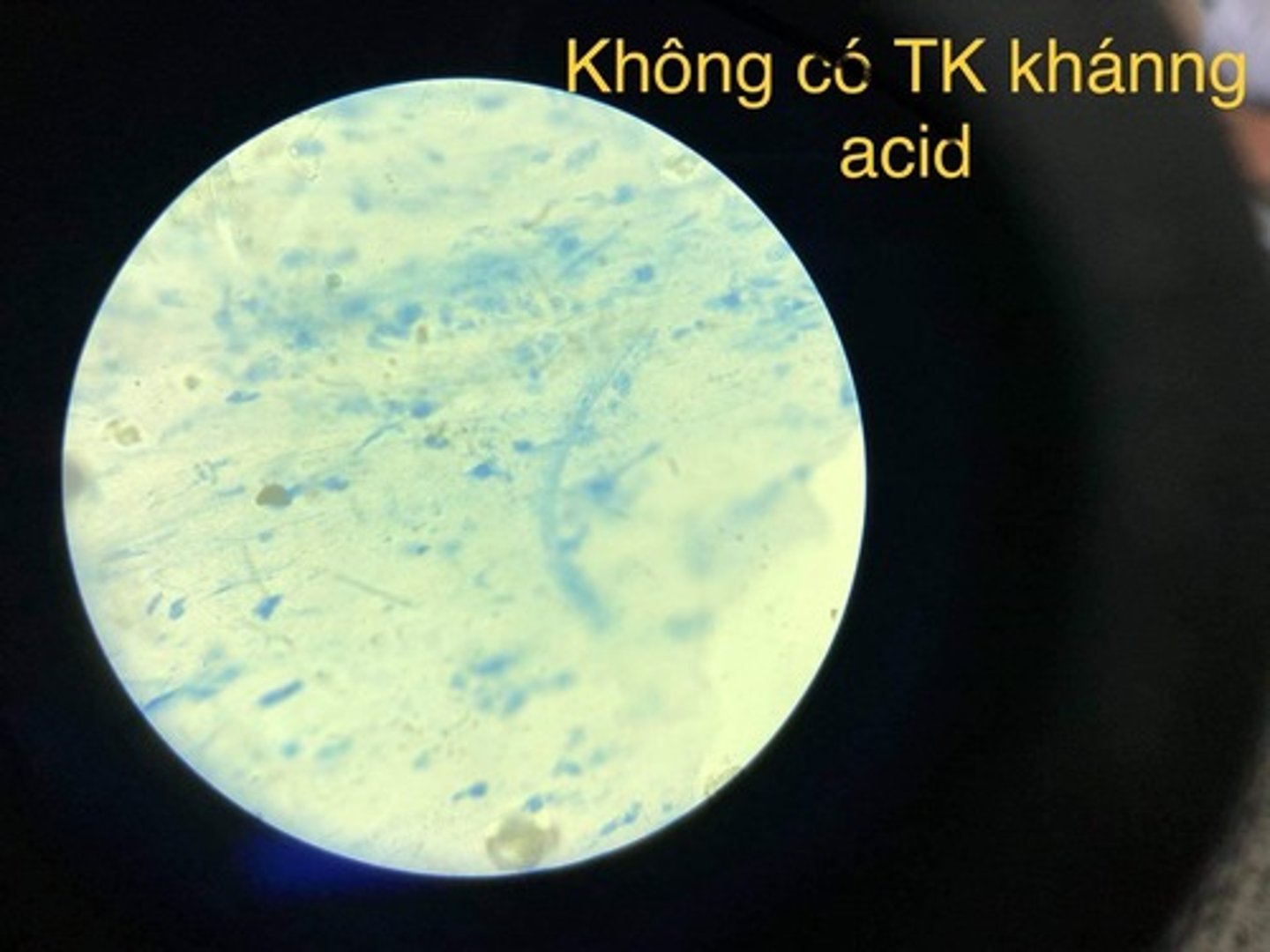 <p><em>Có hoặc không có kháng acid</em></p>