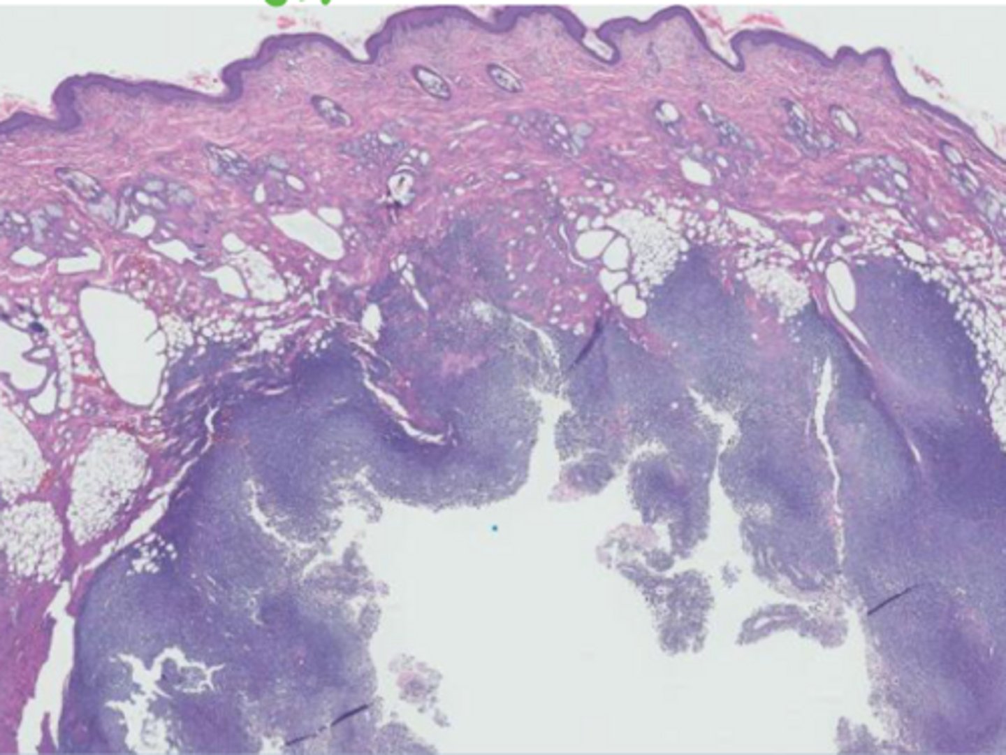 <p>What is animals do vax associated sarcomas related in?</p>