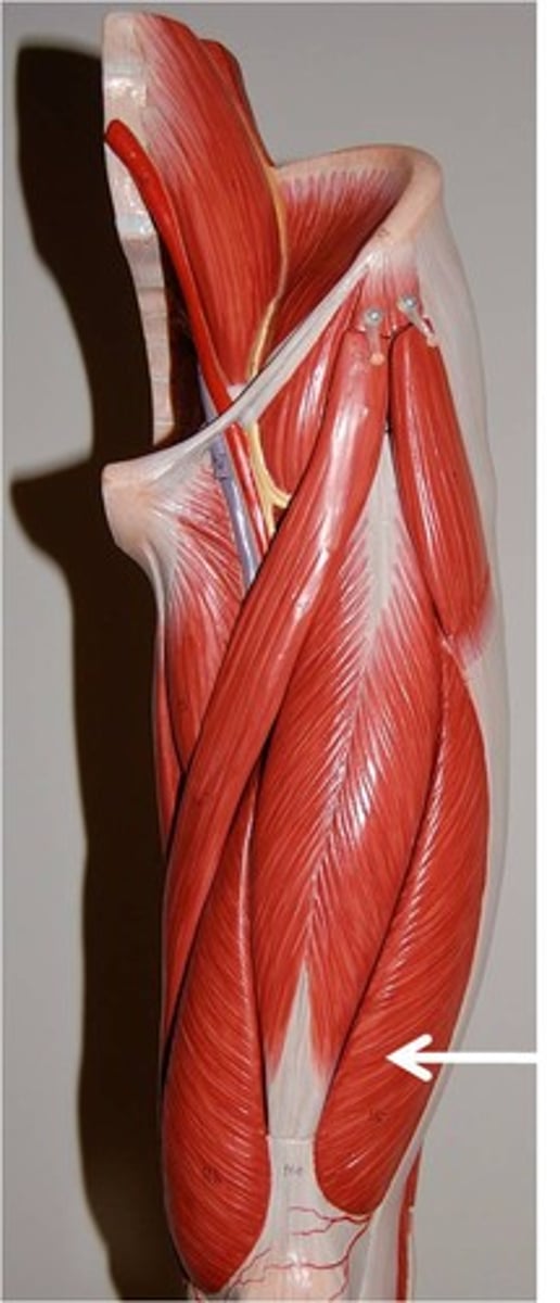 <p>Origin: Greater trochanter of femur, intertrochanteric line, gluteal tuberosity and lateral aspect of linea aspera<br>Insertion: tibial tuberosity via the patellar ligament and also into the patella itself.<br>Action: Flex the thigh and extend the knee<br>Part of quadriceps femoris group</p>