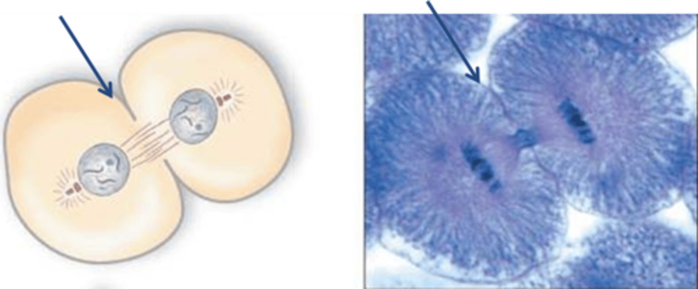 <p>Also known as trench. In animal cells, cytokinesis starts with the formation of _____. It is pulled inward by tiny strands of protein actin.</p>