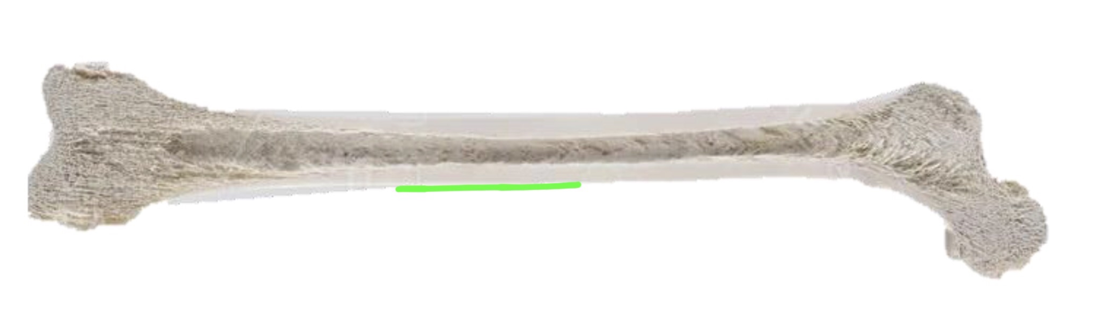 <p>(Membrane)</p>