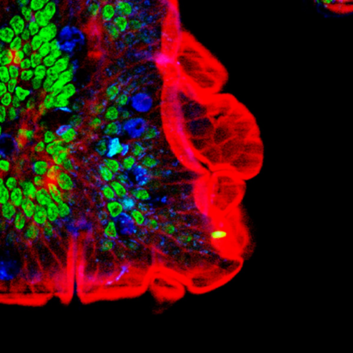 <p>Cells are stained with fluorochrome dyes. Two photons of long-wavelength (red) light are used to excite the dyes. Good for viewing thicker material (e.g. brain slices, embryos, organs, etc.)</p>