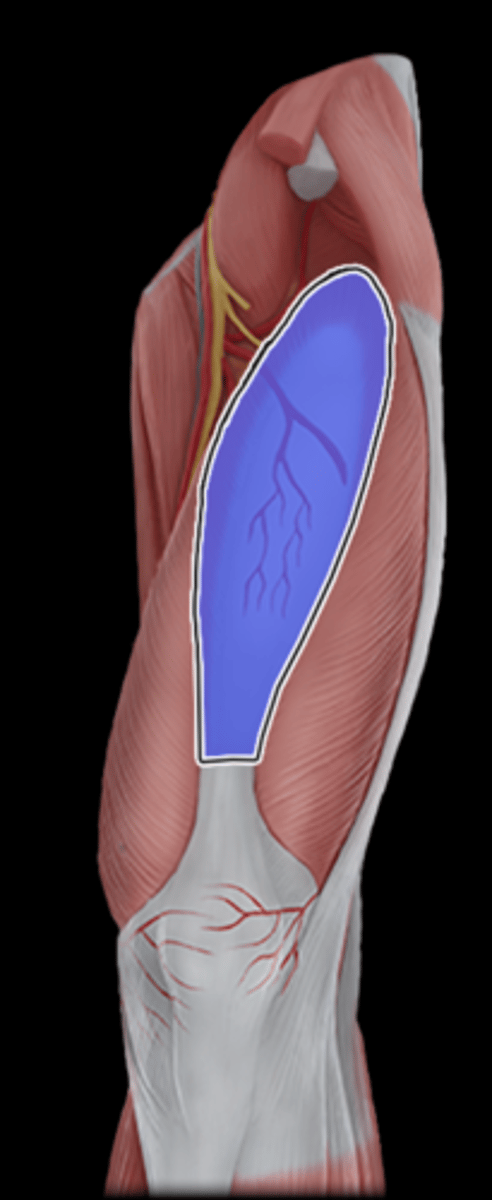 <p>What Muscle Is Highlighted?</p>