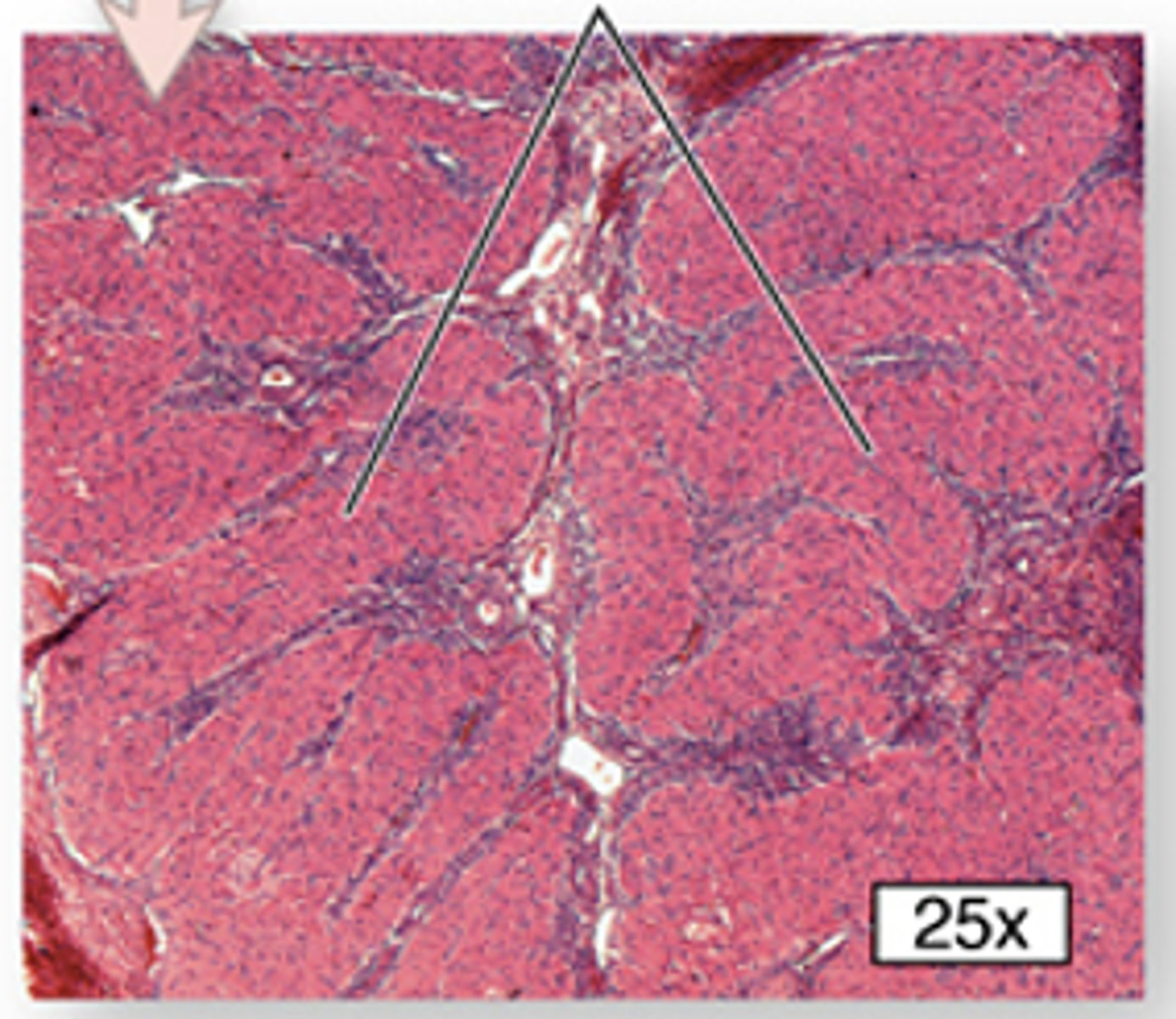 <p>ID the cell:</p>