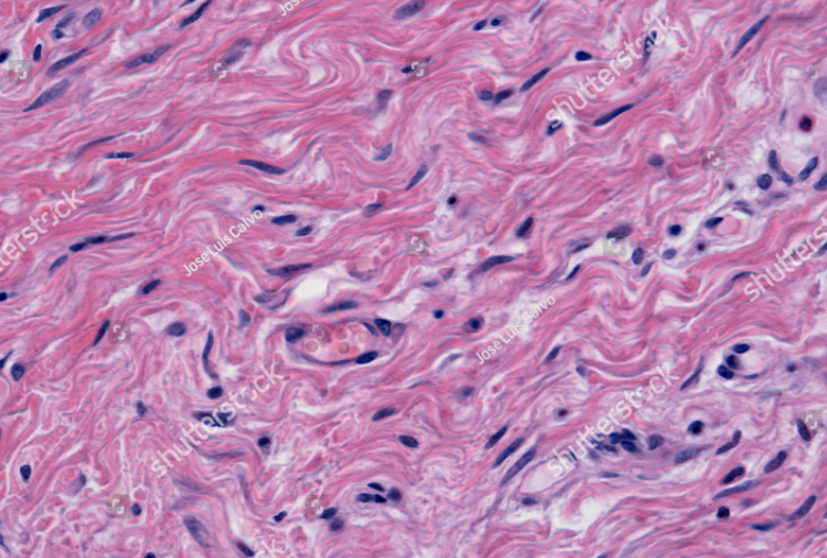<p>connective tissue proper; dense connective tissue. fibrous capsules of organs and of joints; dermis of the skin; submucosa of digestive tract</p>
