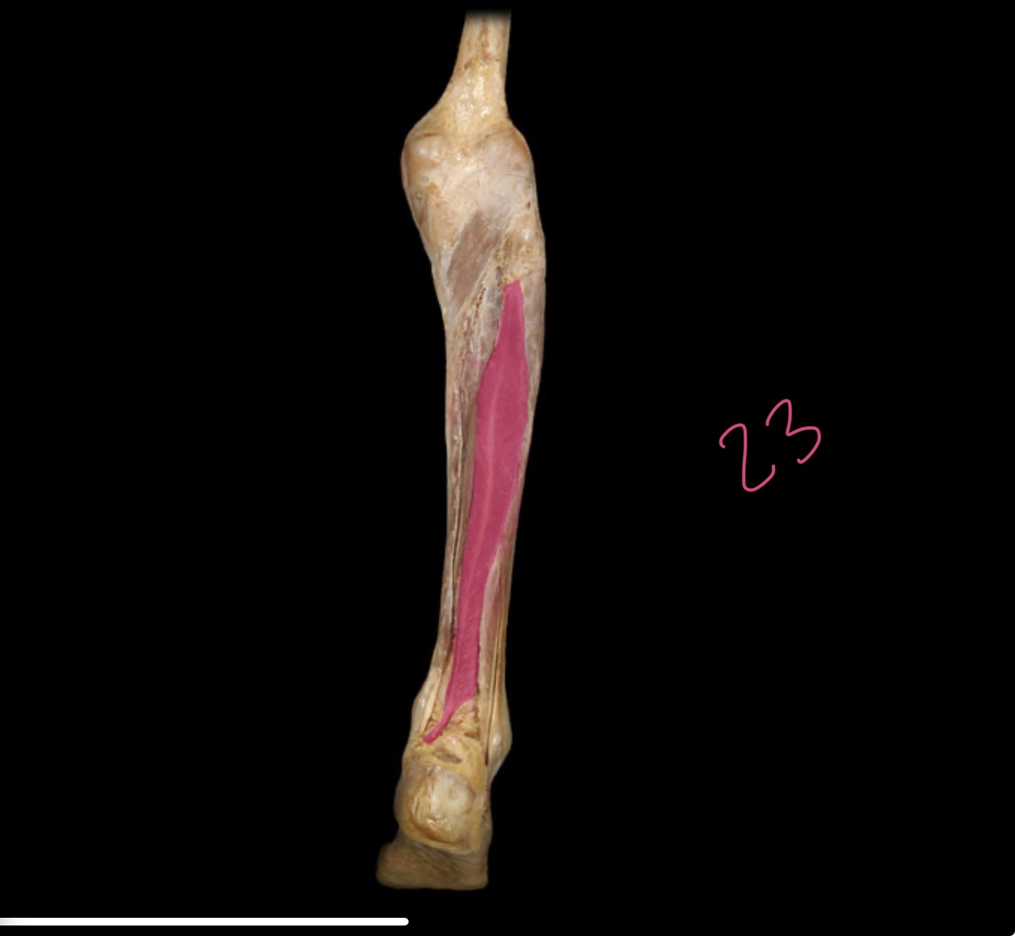 <p>Flexor hallucis</p>