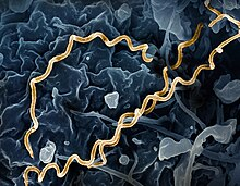 <p>Has 3 phases, a STD. What is the name of the bacteria</p>