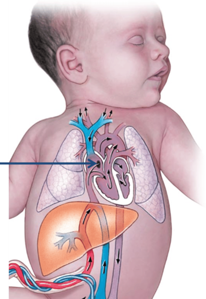 <p>Name this fetal opening.</p>