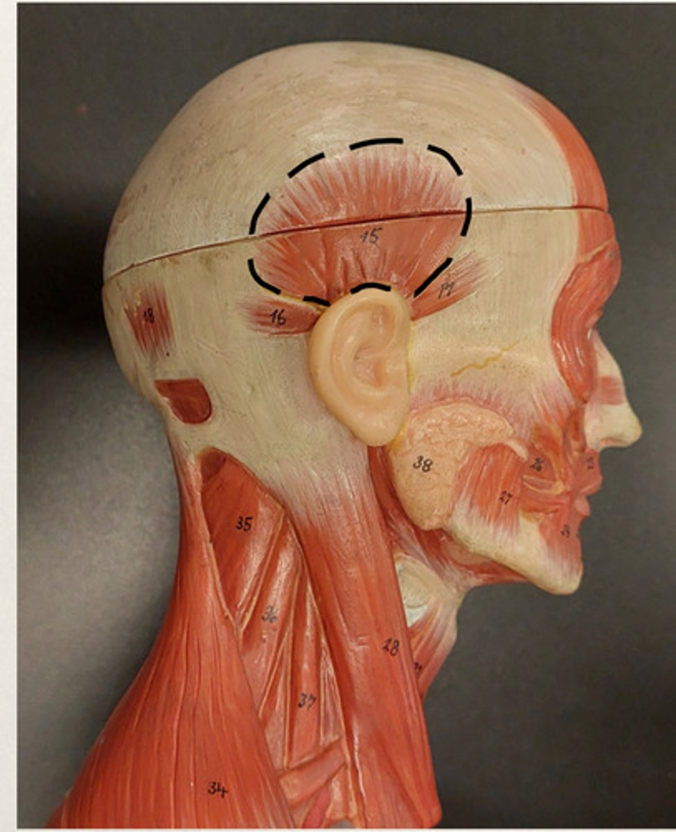 <p>identify superior to temporalis</p>