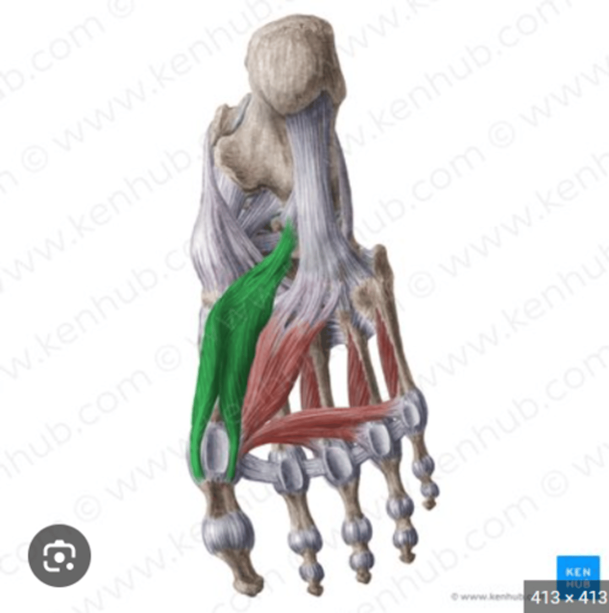 <p>what is the muscle highlighted in the picture?</p>