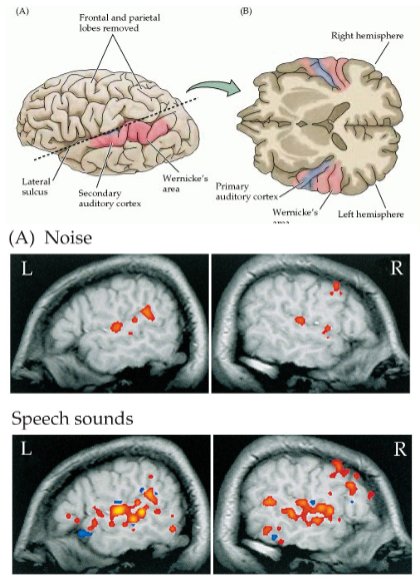 <p>the <strong>primary auditory cortex</strong> (inner surface of lateral sulcus) is activated when listening to random noise</p><p><strong>higher auditory areas</strong> (adjacent to superior temporal gyrus) are activated when listening to words &amp; speech</p>