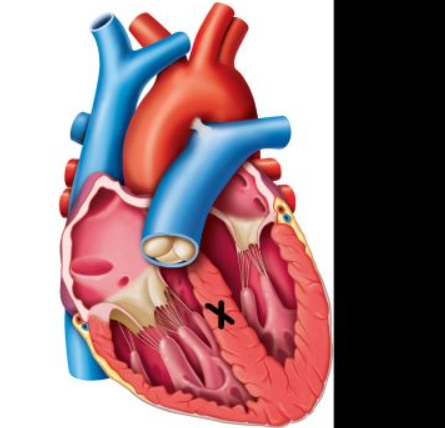 <ul><li><p>tricuspid valve</p></li><li><p>interventricular septum</p></li><li><p>pulmonary trunk</p></li><li><p>bicuspid (mitral) valve</p></li></ul><p></p>