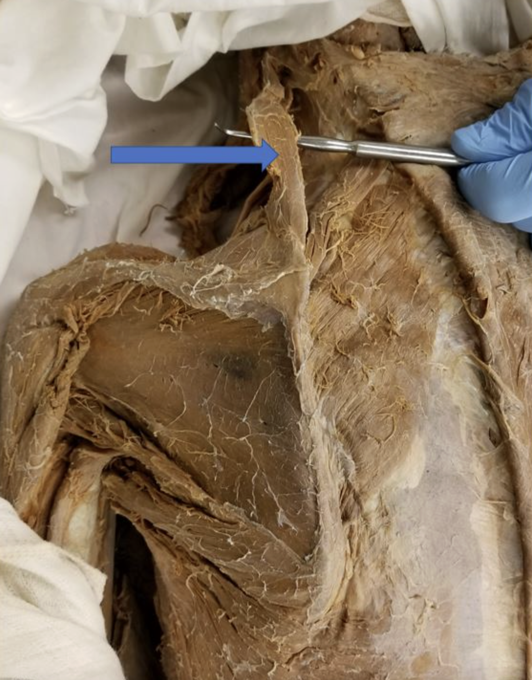 <p>muscle name & action</p>