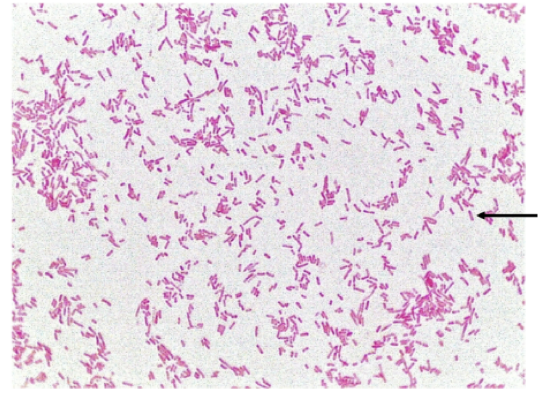 <p>1) identify the grams stain reaction</p><p>2) identify this bacterial shape</p><p>3) arrangement </p>