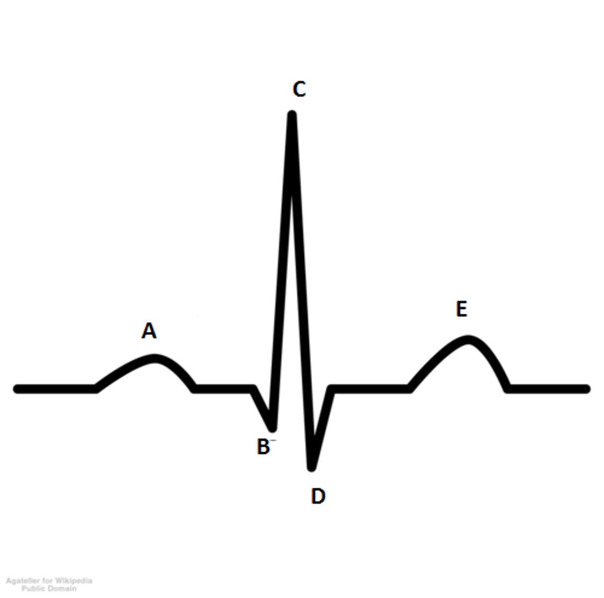 <p>What part of the EKG wave is indicated by the letter C?</p>