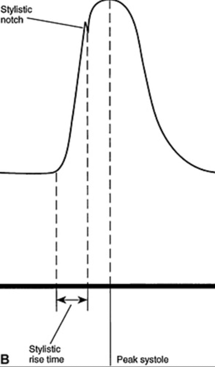 <p>Rapid upstroke</p><p>Early systolic peak</p>
