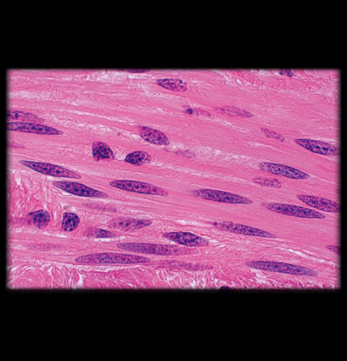 <p>- Non-striated, involuntary muscle.</p><p>- Cells are spindle-shaped (long and tapered) with a single, centrally located nucleus.</p><p>- Appears as smooth, uniform layers of elongated cells under the microscope with no visible striations.</p><p>- Found in the walls of hollow organs like the intestines, blood vessels, and uterus.</p>