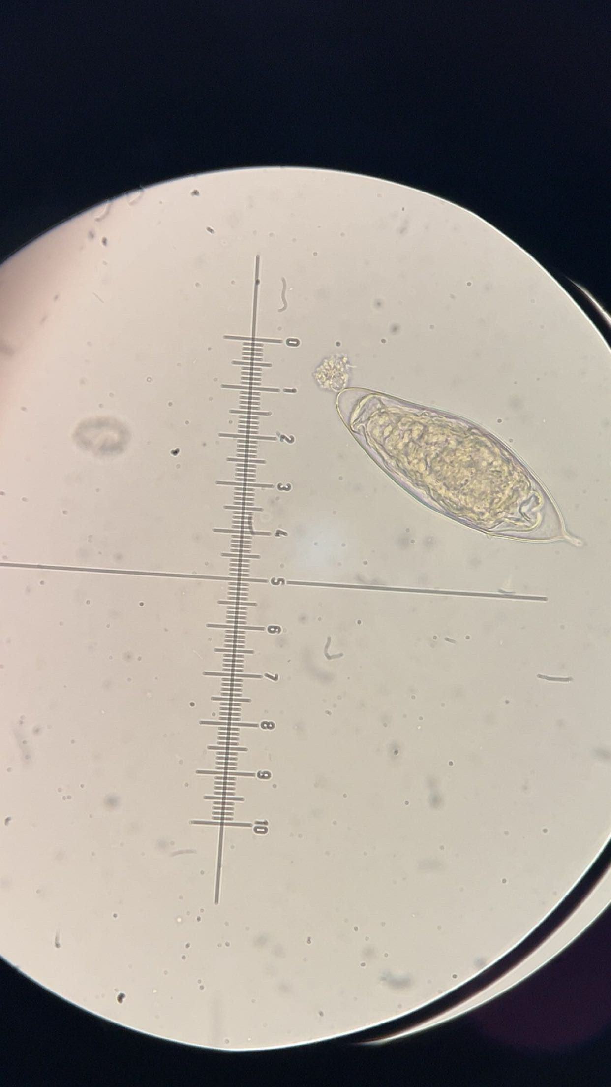 <p><em>Schistosoma haematobium </em>egg</p>