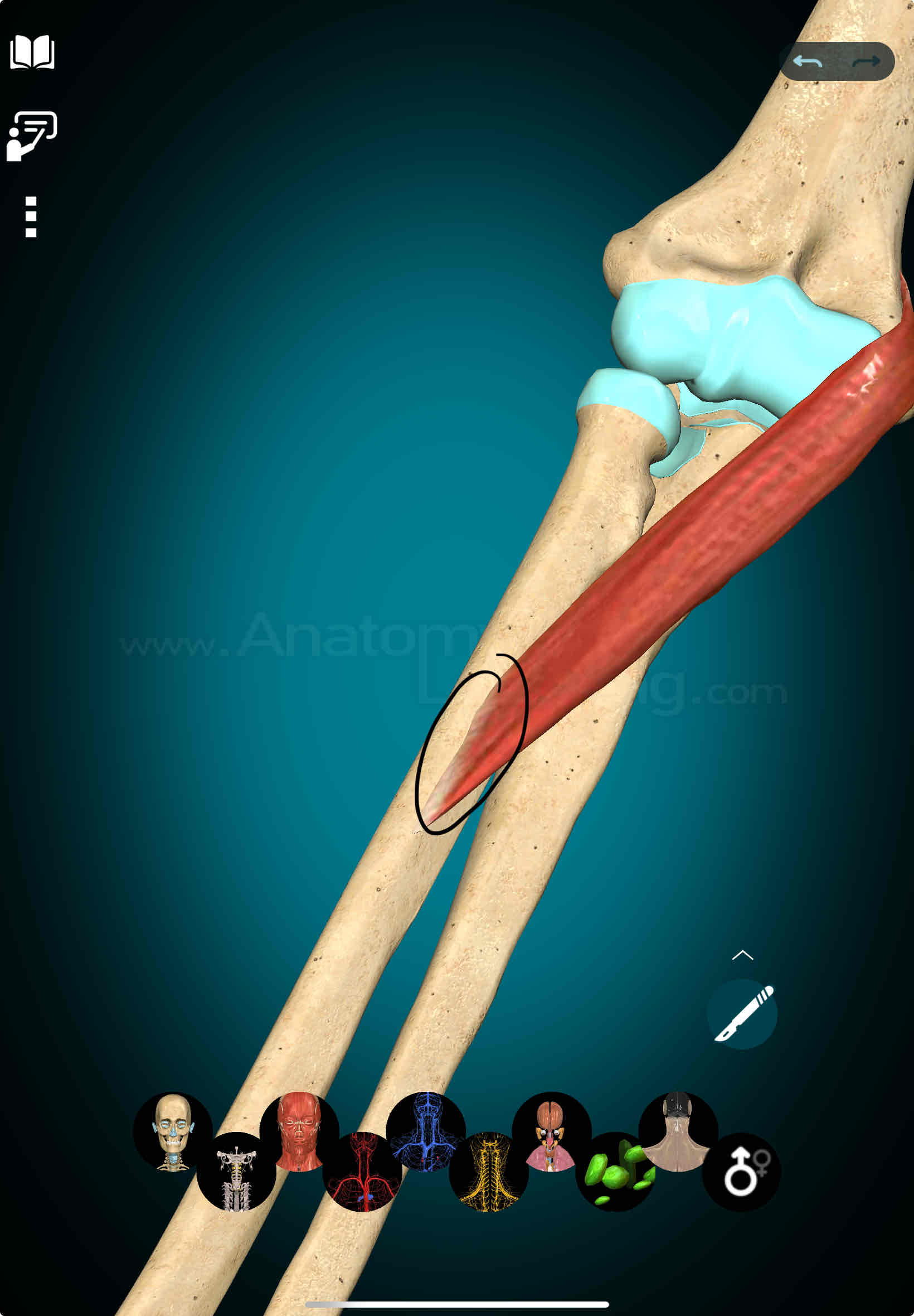<p>Pronator Teres Insertion</p>