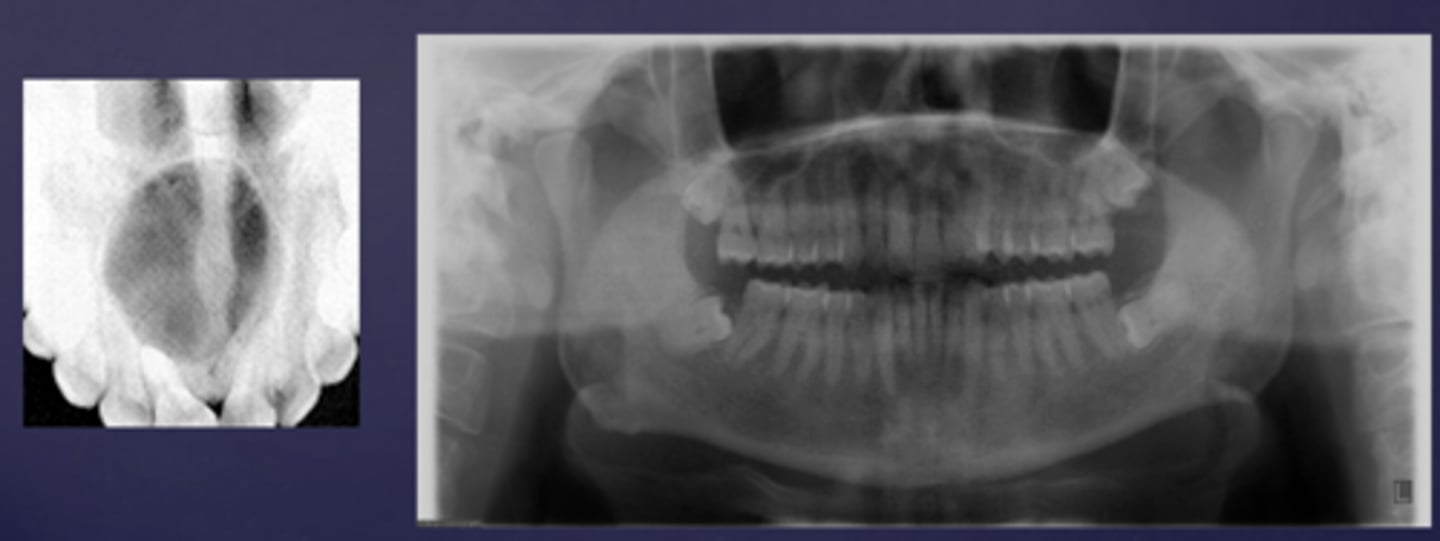 <p>What would be a differential diagnosis for these lesions?</p>