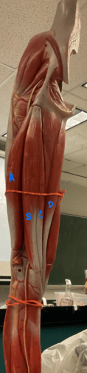 <p>biceps femoris</p>