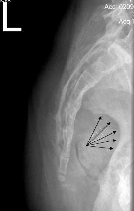 <p>no rotation</p><ul><li><p>MAIN: greater sciatic notches are SI ant/post</p></li><li><p>femoral head are SI ant/post</p></li></ul><p></p>