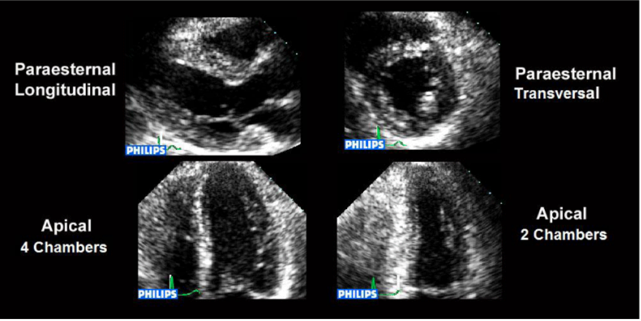 <p>Baseline images </p>