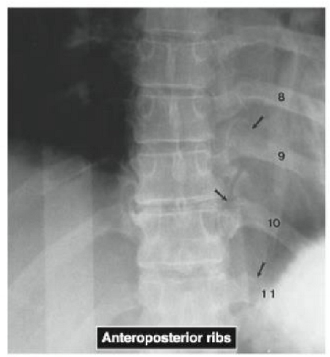 <p>What is this radiograph showing?</p>