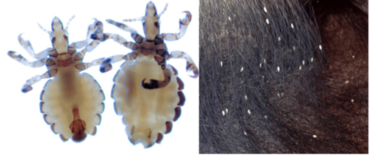 <p>Head is narrower than the thorax;</p><p>Obvious angular process (ocular points) behind the antennae;</p><p>- Paratergal plates</p><p>Three pairs of legs that have the same size.</p><p>Feed on blood;</p>