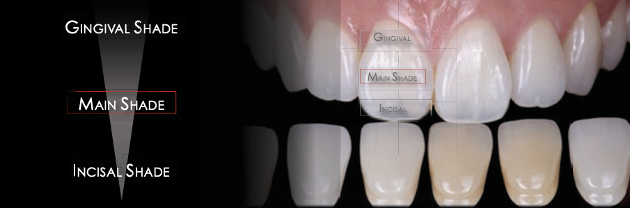 <p>A shade: reddish brown</p><p>B shade: reddish yellow</p><p>C shade: grayish</p><p>D shade: reddish gray</p>