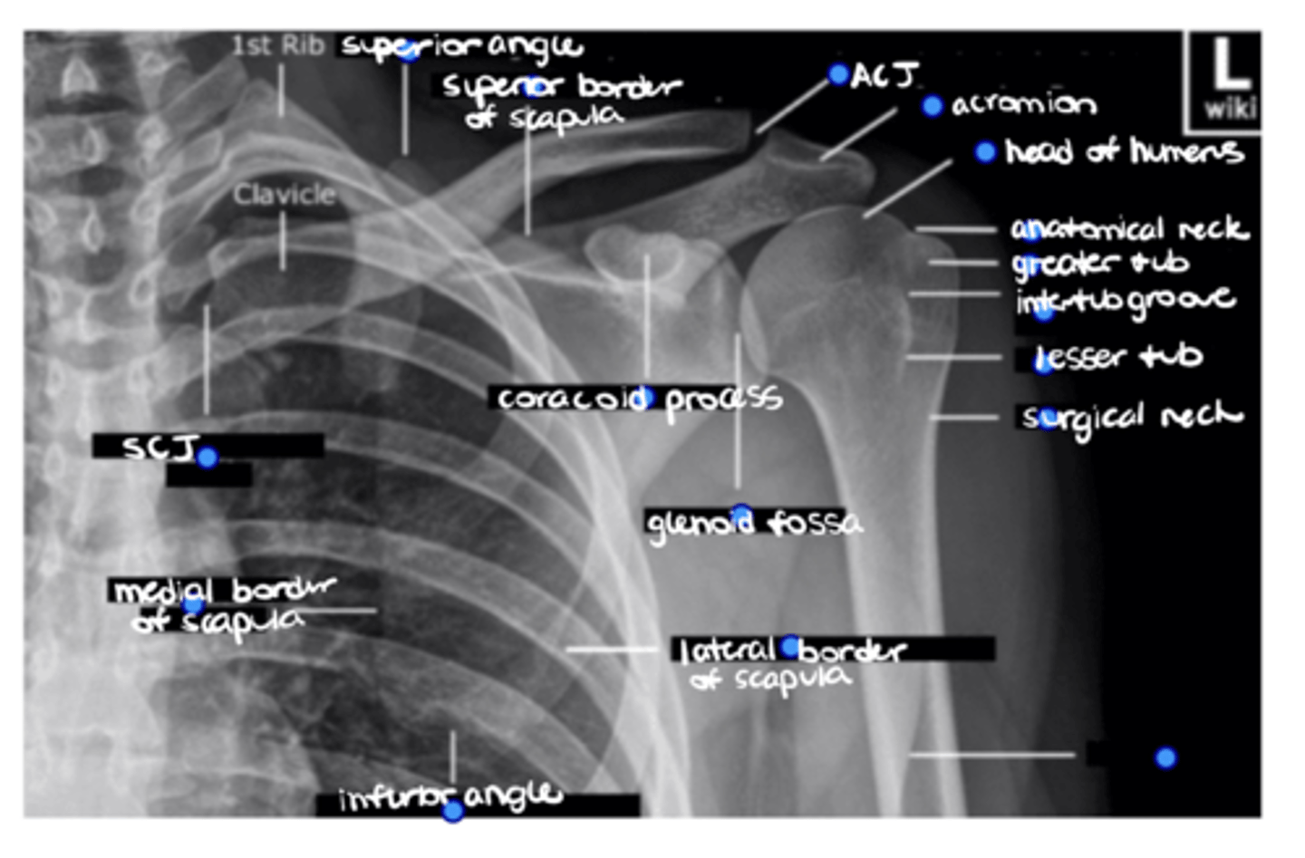 <p>ID the missing structure.</p>