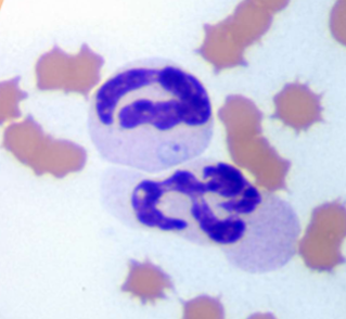 <p>What does <span style="color: rgb(255, 255, 255);"><span>Theileria equi (formerly Babesia equi); Babesia caballi cause </span></span></p>