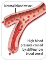 <p>The Heart: a muscular organ that continuously pumps blood through the body, generating blood flow. </p><p>The Blood Vessels: a system of hollow tubes through which the blood moves. </p><p>The Blood: The fluid that transports nutrients, O2, CO2 and many other materials throughout the body.</p><p></p>