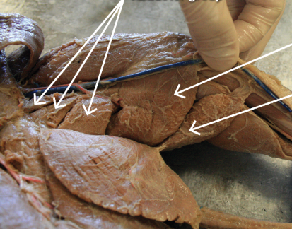 <p>bottom arrow </p>