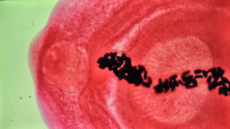 <p><span data-name="microscope" data-type="emoji">🔬</span><span data-name="petri_dish" data-type="emoji">🧫</span><strong><span> </span>Na podstawie zdjęcia preparatu:</strong></p><p></p><ul><li><p><span data-name="book" data-type="emoji">📖</span><span> </span>rozpoznaj gatunek pasożyta;</p></li></ul><p></p><ul><li><p><span data-name="recycle" data-type="emoji">♻</span><span> </span>rozpoznaj wszystkie formy rozwojowe;</p></li></ul><p></p><ul><li><p><span data-name="microbe" data-type="emoji">🦠</span><span> </span>wskaż organelle i cechy charakterystyczne dla danego gatunku;</p></li></ul><p></p><ul><li><p><span data-name="mask" data-type="emoji">😷</span><span> </span>nazwij chorobę, którą pasożyt wywołuje.</p></li></ul><p></p>