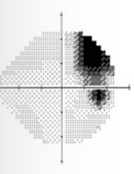 <p>What kind of defect is this</p>