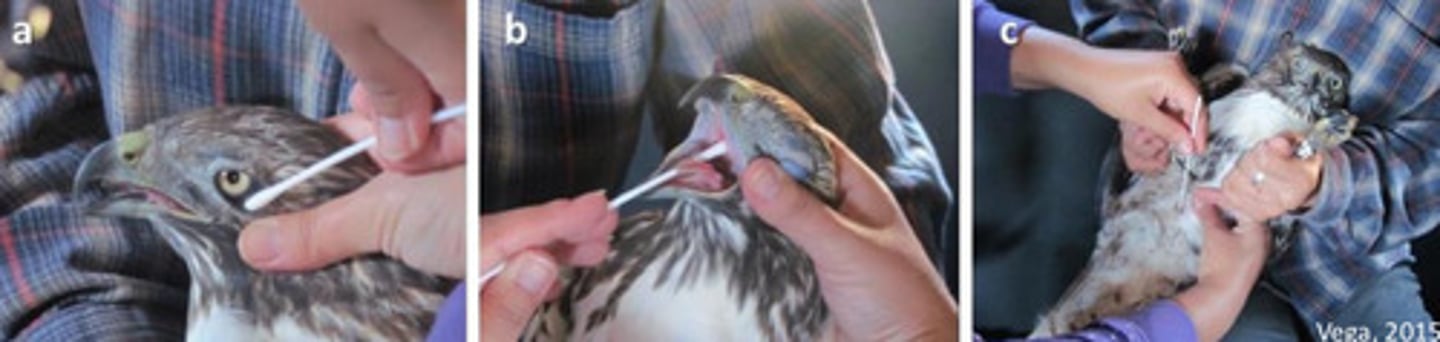 <p>How do you do a CCC swab (in what order), and what do you use it for?</p>