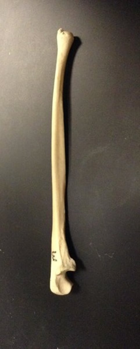 <p>ID bone</p>