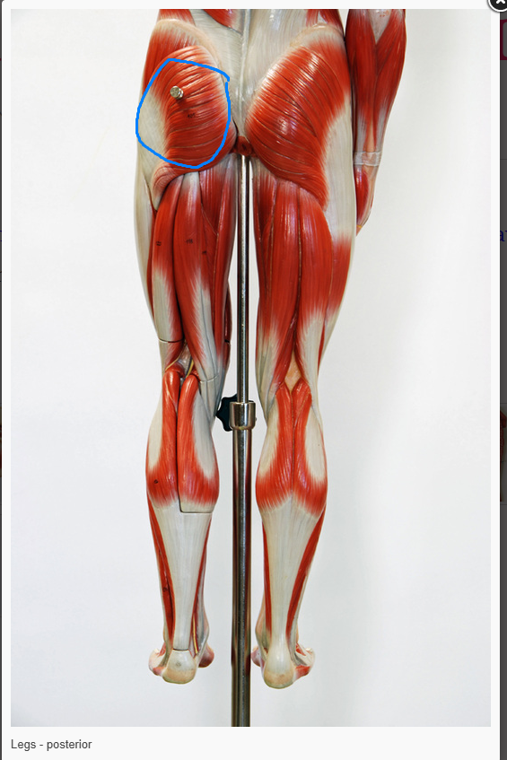 <p>What is the name of the muscle circled </p>