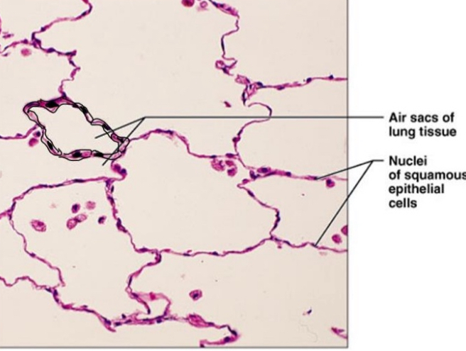 <ul><li><p>Squamous cells</p></li></ul><p></p>
